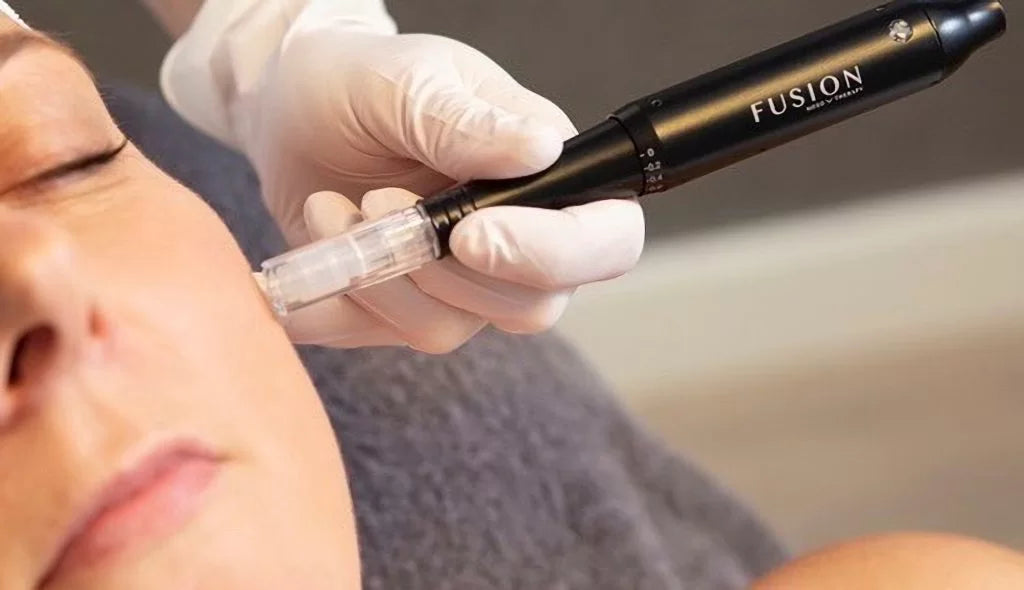 The lowdown on microneedling